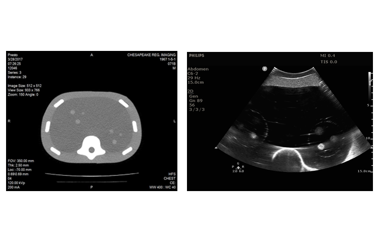 美國(guó)CIRS 071B腹部穿刺模體