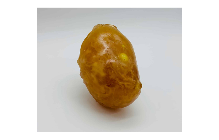 加拿大Truephantom成人乳房模體