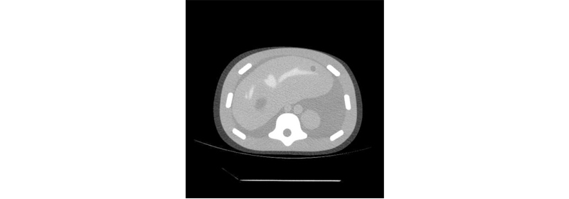 CIRS 057A腹部模體